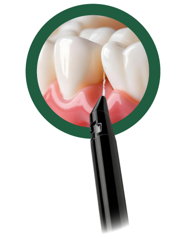 LACLEVER - nástavec lopatka na jazyk